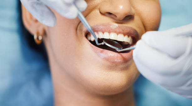 Best Urgent Dental Care for Toothache in Roanoke, VA